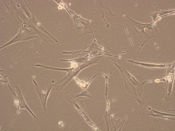 培養したヒト皮膚の老化細胞の顕微鏡写真。肥大化・扁平化し、増殖が止まっている。